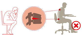 Darstellung der falschen Sitzhaltung, welche für Bandscheibenprobleme sorgt